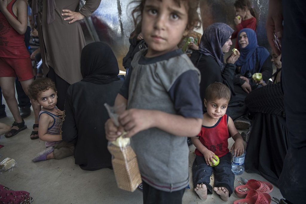 Barnen i det improviserade fältsjukhuset i östra Mosul har precis fått lämna områden i gamla stan där striderna mellan irakiska armén och IS är hårda. Flera av dem uppvisar symptom på undernäring. Foto: Jerker Ivarsson